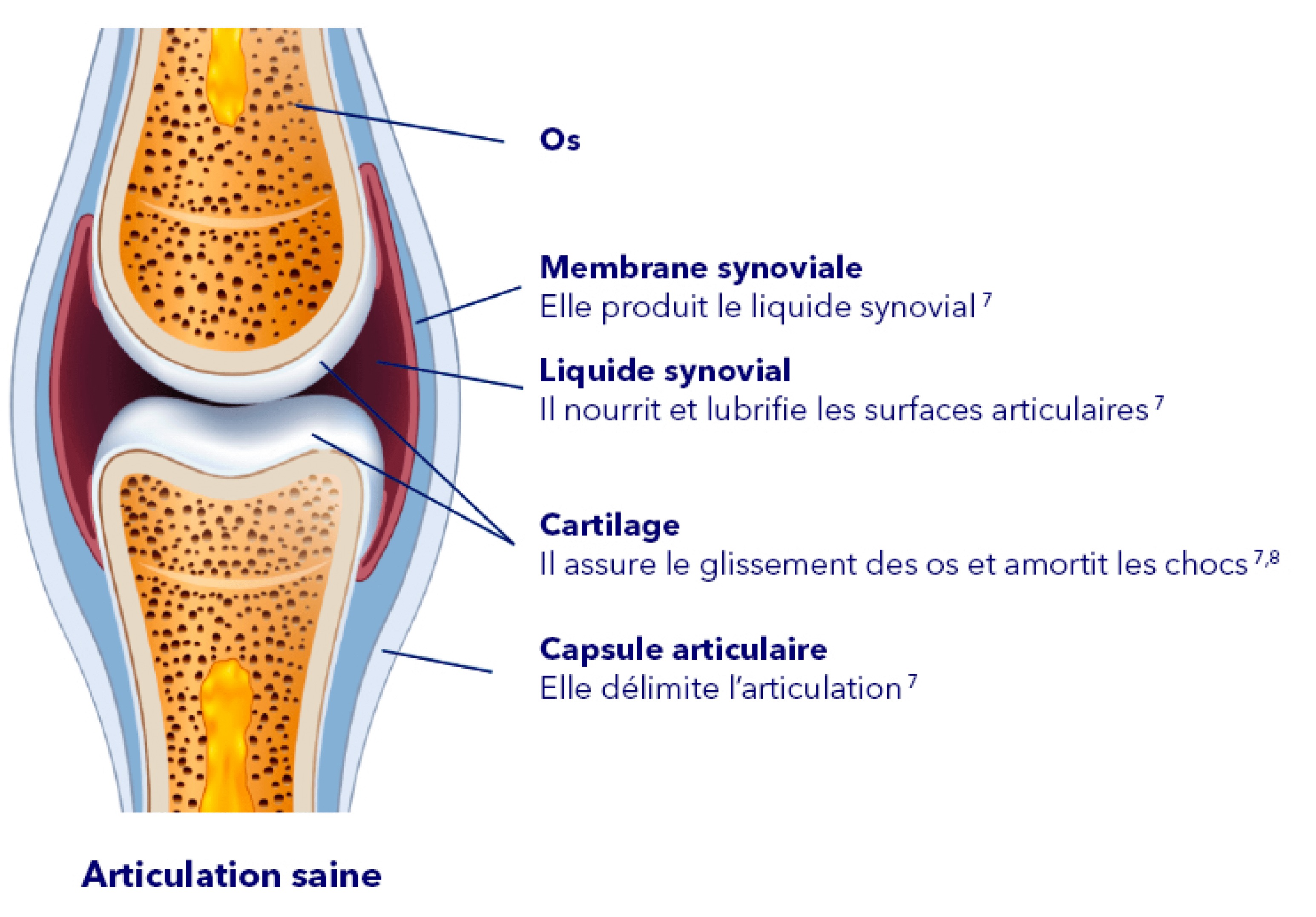 articulation sans arthrose